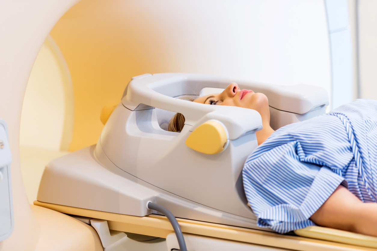 radioterapia para glioma