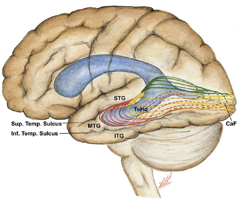 Summary of the Optic Radiation Relations with the Sulci, Gyri, and