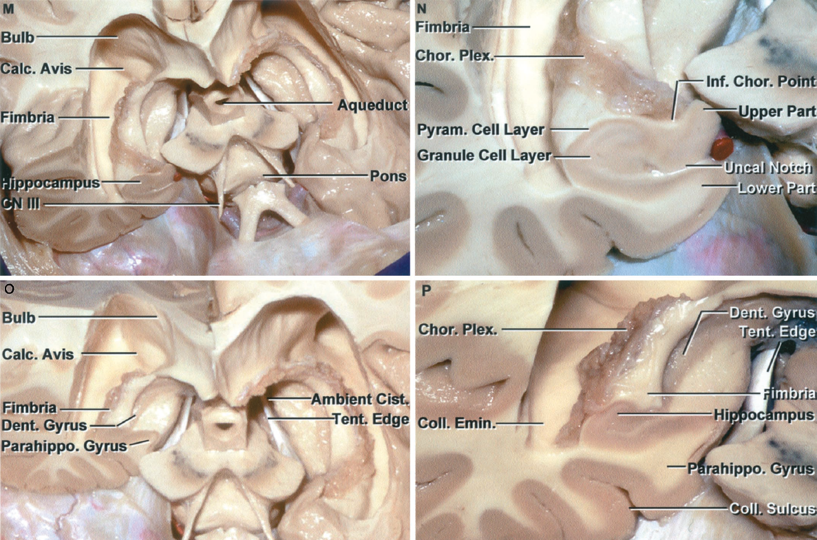 Stepwise Dissection of the Cerebral Hemispheres, Beginning Anteriorly M