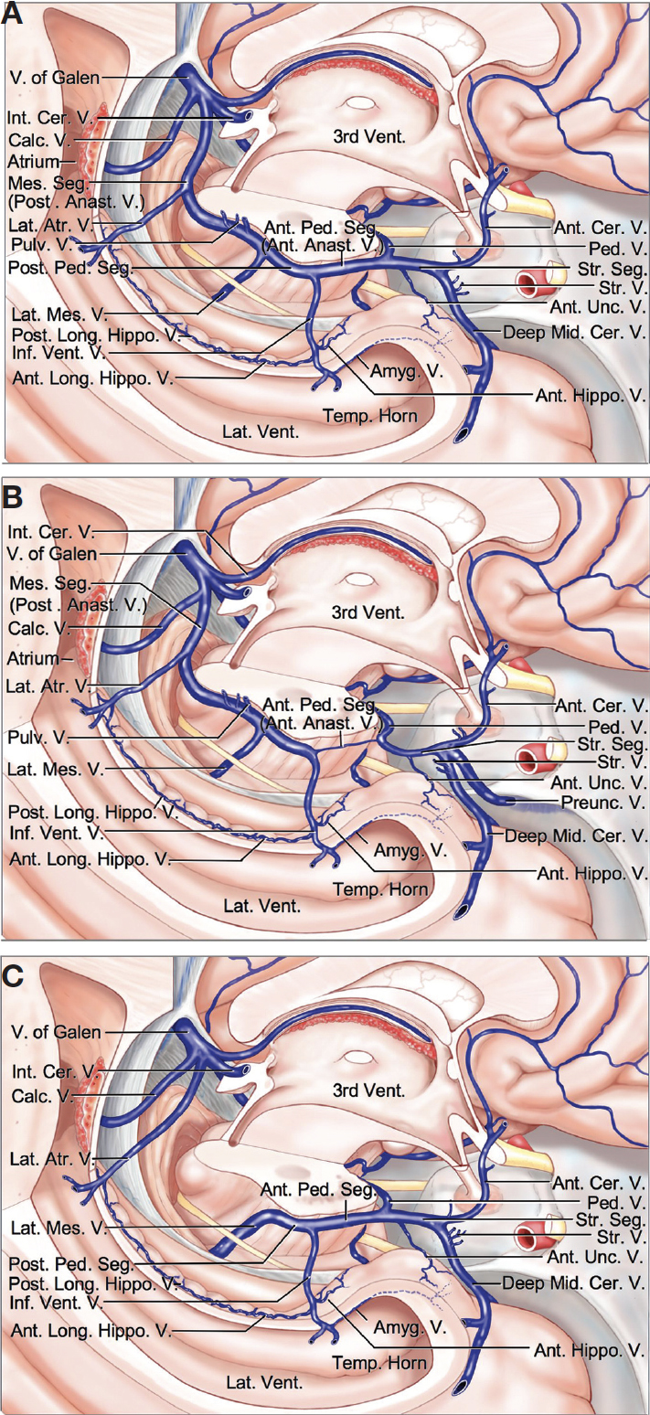 Variations in the Basal Vein | Neuroanatomy | The Neurosurgical Atlas
