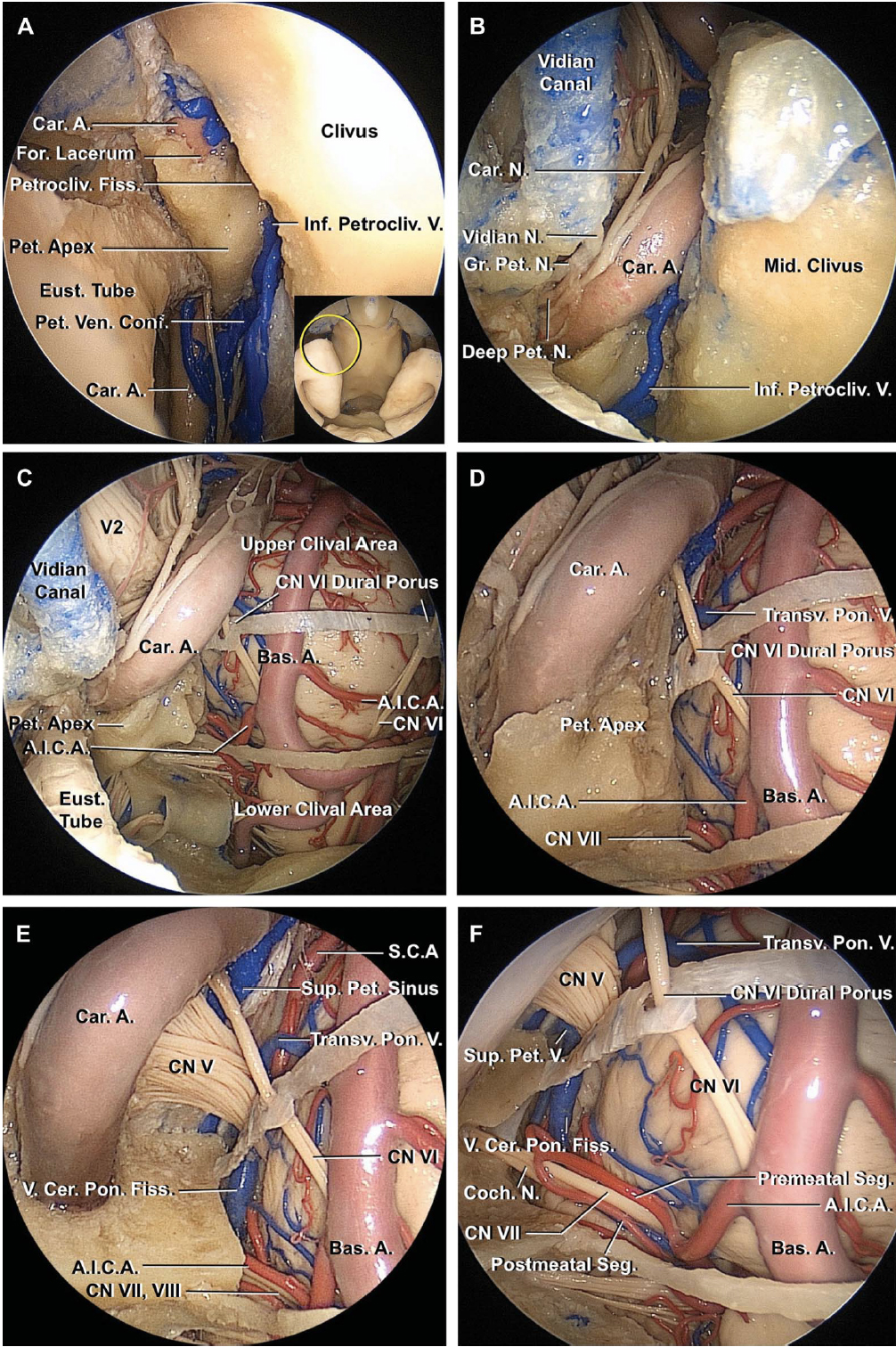 Endoscopic Approach to the Middle Clivus | Neuroanatomy | The
